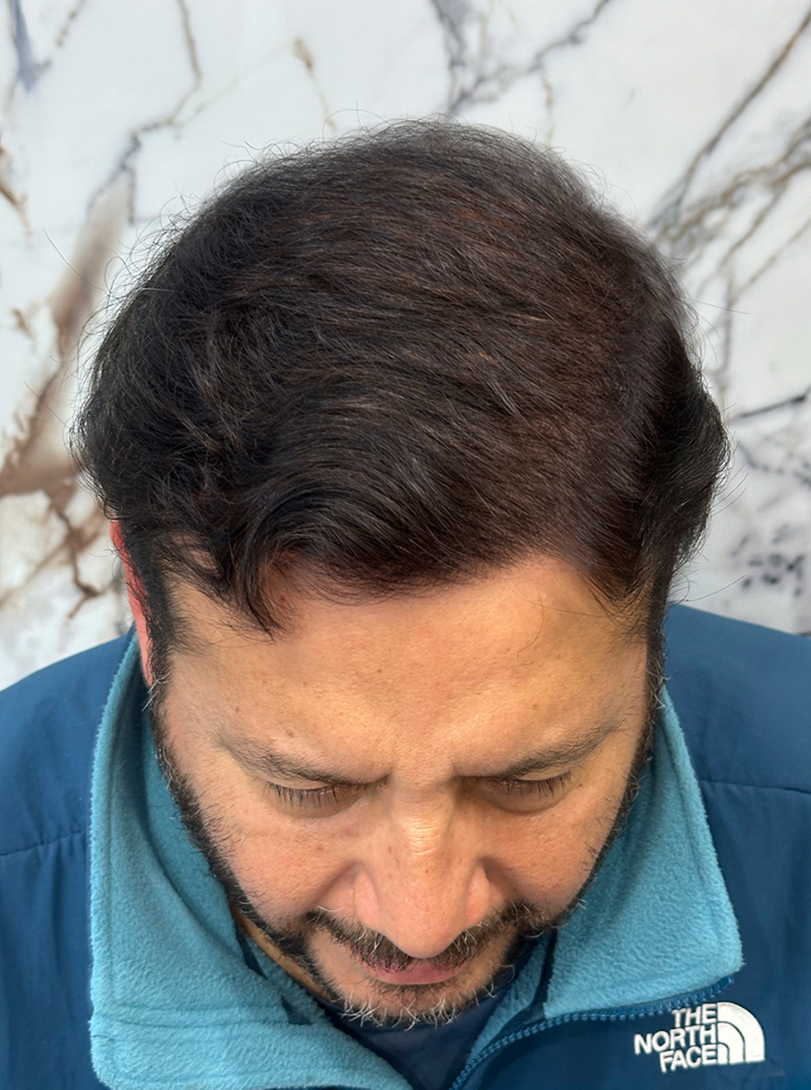 Diseño